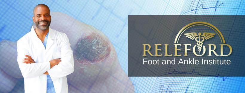 Way To Reduce Risk of Amputation | Releford Foot And Ankle&nbsp;Institute