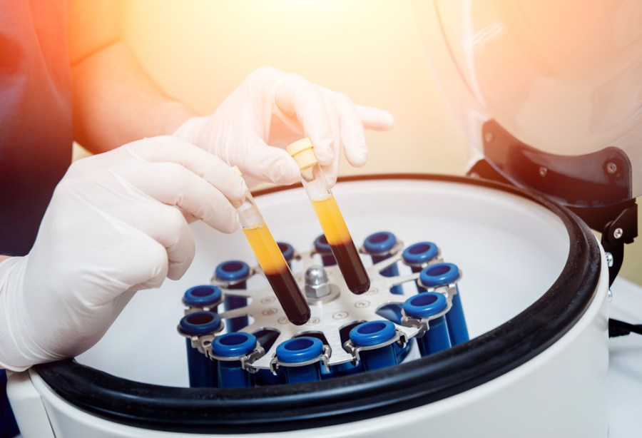 Ways To Treat Heel Pain Using Platelet-Rich Plasma&nbsp;Therapy